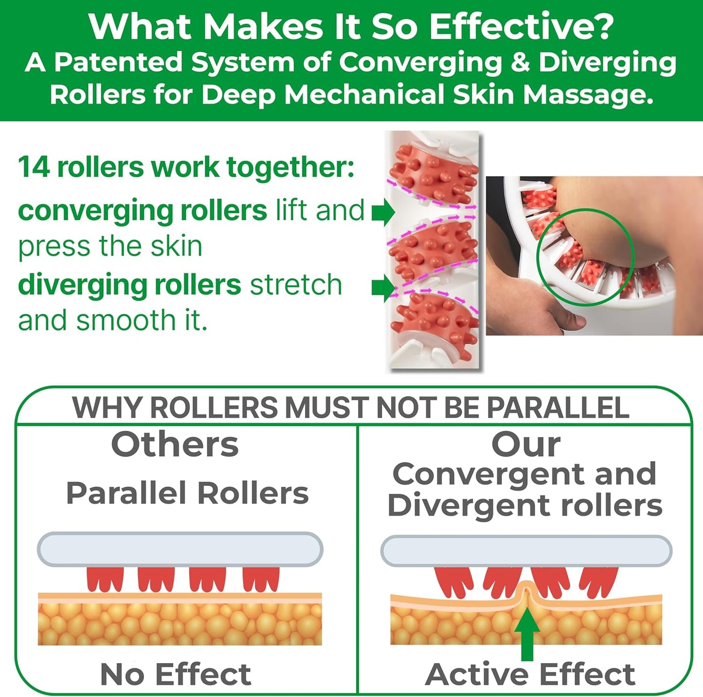 Anti-Cellulite Massage Roller