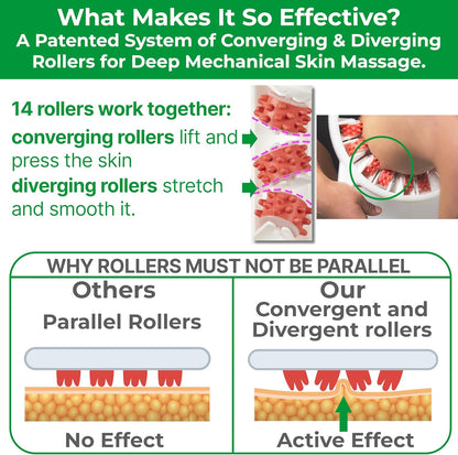 Anti-Cellulite Massage Roller