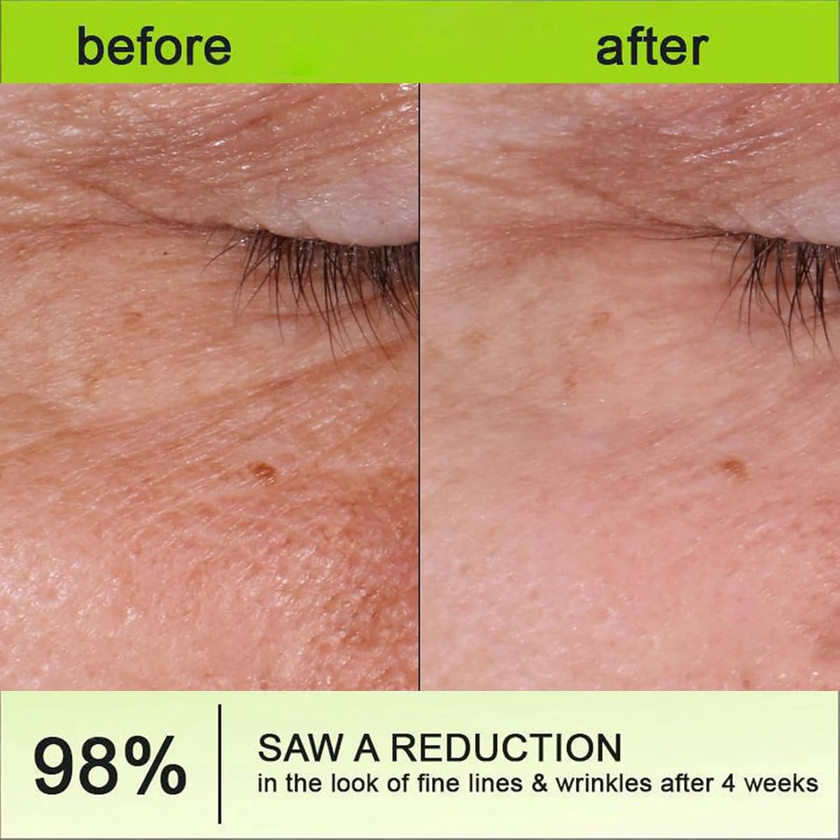 Retinal Shot Tightening Booster